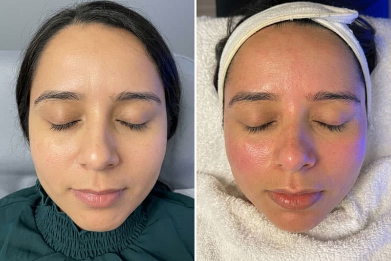 Premium Repechage Care
