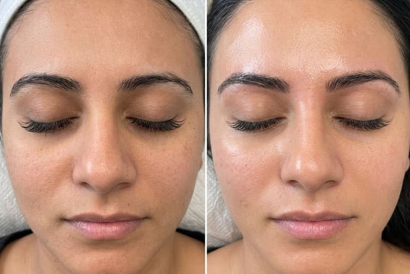 Precision Brow Waxing